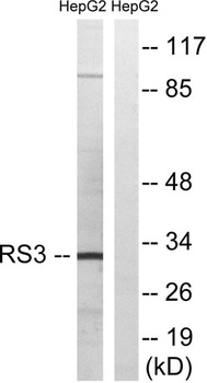 Ribosomal Protein S3 rabbit pAb Antibody