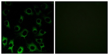 Ribosomal Protein S4X rabbit pAb Antibody
