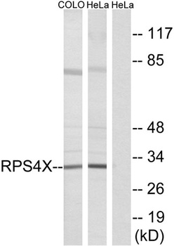 Ribosomal Protein S4X rabbit pAb Antibody