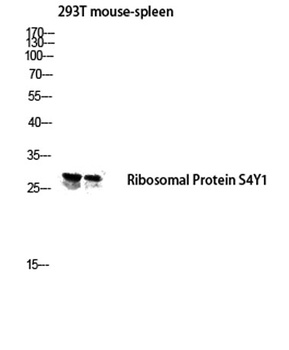 Ribosomal Protein S4Y1 rabbit pAb Antibody