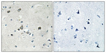 Ribosomal Protein S4Y1 rabbit pAb Antibody