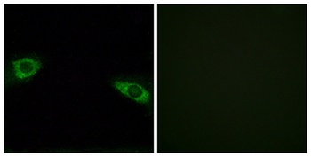 Ribosomal Protein S4Y1 rabbit pAb Antibody