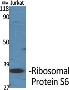 Ribosomal Protein S6 rabbit pAb Antibody