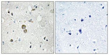 Ribosomal Protein S9 rabbit pAb Antibody