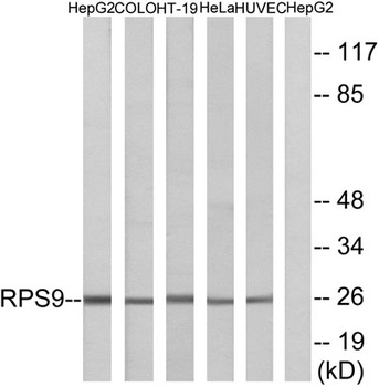 Ribosomal Protein S9 rabbit pAb Antibody
