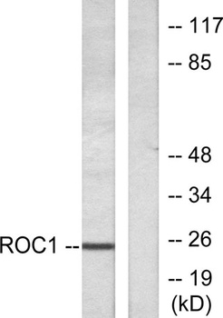 Rit1 rabbit pAb Antibody