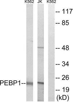RKIP rabbit pAb Antibody