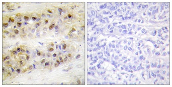 RORα rabbit pAb Antibody