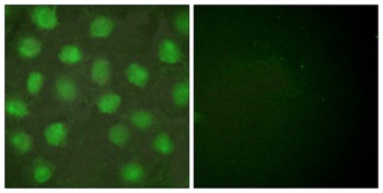 RXRγ rabbit pAb Antibody