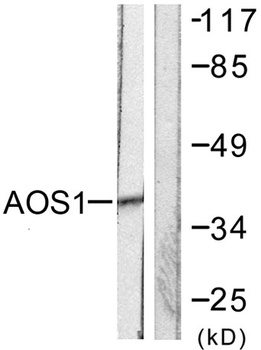 SAE1 rabbit pAb Antibody