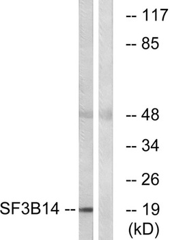 SAP 14 rabbit pAb Antibody