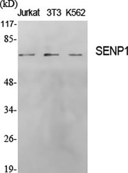 SENP1 rabbit pAb Antibody