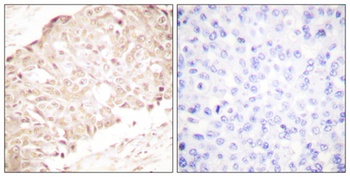 SENP1 rabbit pAb Antibody