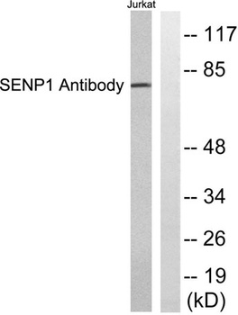SENP1 rabbit pAb Antibody