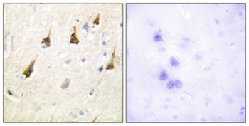 SENP7 rabbit pAb Antibody