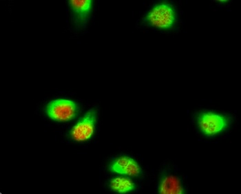SGK1 rabbit pAb Antibody