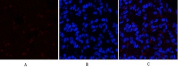 SGK1 rabbit pAb Antibody