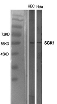 SGK1 rabbit pAb Antibody