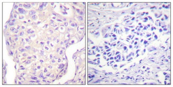 SH-PTP2 rabbit pAb Antibody