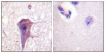 SH-PTP2 rabbit pAb Antibody