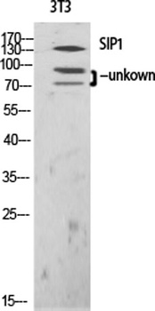 SIP1 rabbit pAb Antibody