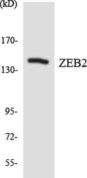 SIP1 rabbit pAb Antibody