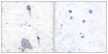 SIRP-α1 rabbit pAb Antibody