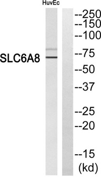 SLC6A8 rabbit pAb Antibody