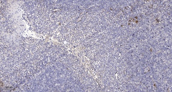 SLC6A8 rabbit pAb Antibody