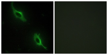 sMtCK rabbit pAb Antibody