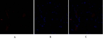 SNAI 1 rabbit pAb Antibody