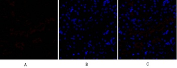 SNAI 1 rabbit pAb Antibody