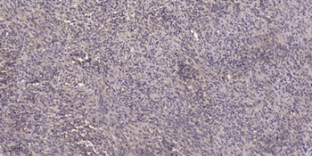 SNX1 rabbit pAb Antibody