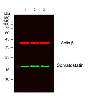 Somatostatin rabbit pAb Antibody