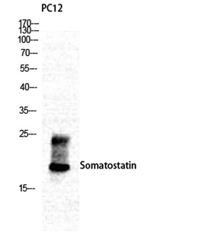 Somatostatin rabbit pAb Antibody