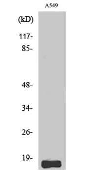 Somatostatin rabbit pAb Antibody