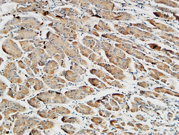 Somatostatin rabbit pAb Antibody
