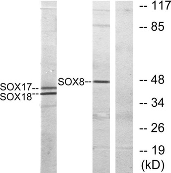 Sox-8/9/17/18 rabbit pAb Antibody