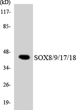 Sox-8/9/17/18 rabbit pAb Antibody