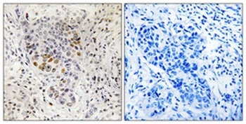 Sp1 rabbit pAb Antibody