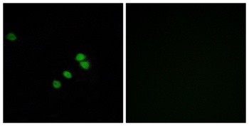 Sp1 rabbit pAb Antibody