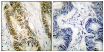 Sp1 rabbit pAb Antibody
