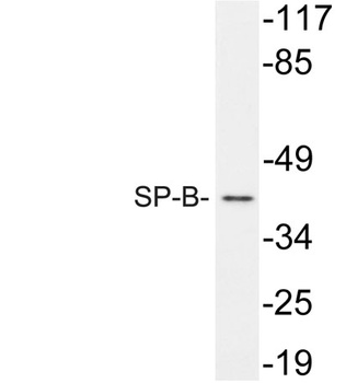 SP-B rabbit pAb Antibody