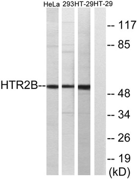 SR-2B rabbit pAb Antibody