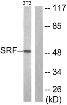 SRF rabbit pAb Antibody