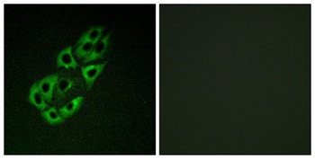 SSBP1 rabbit pAb Antibody