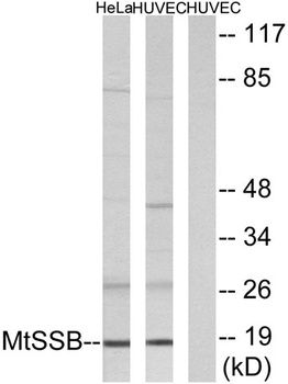 SSBP1 rabbit pAb Antibody