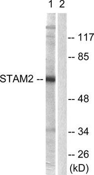 STAM2 rabbit pAb Antibody