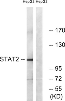 Stat2 rabbit pAb Antibody