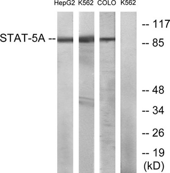 Stat5 rabbit pAb Antibody